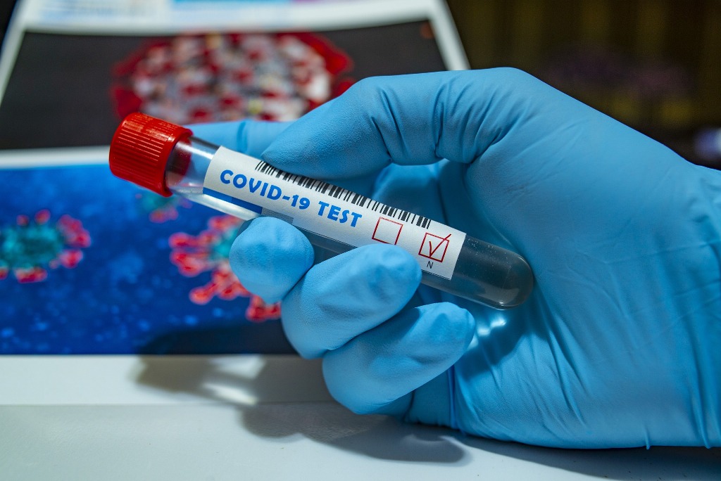 Covid-19 test