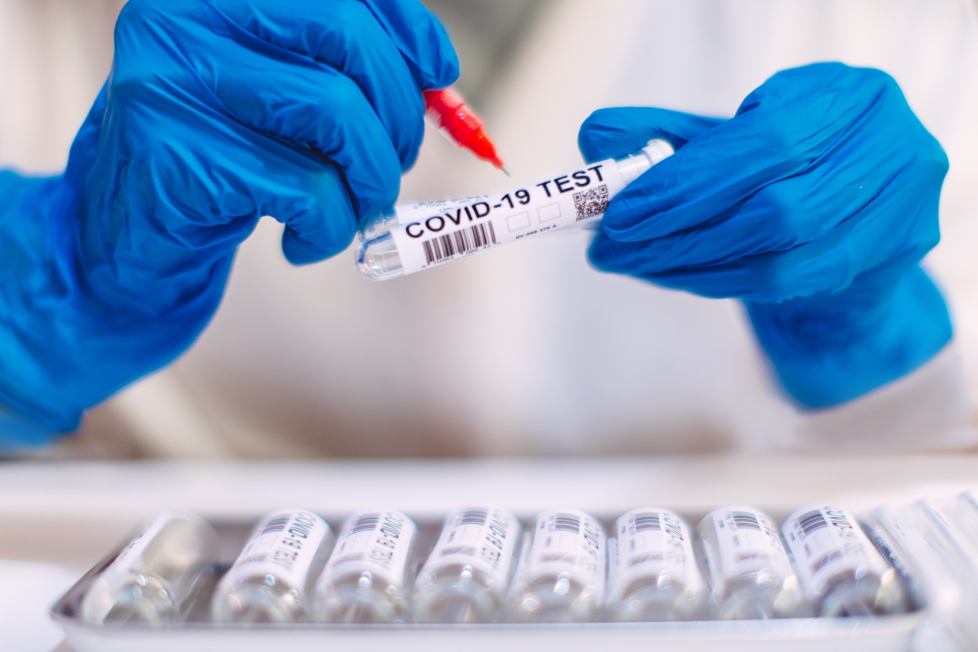 Covid-19 test