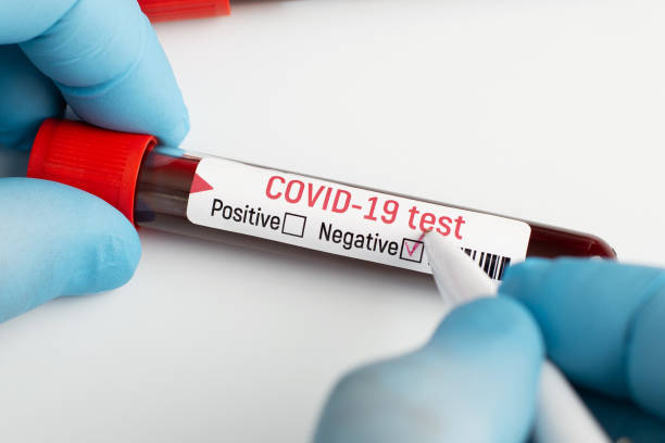 covidtest 31.12.21