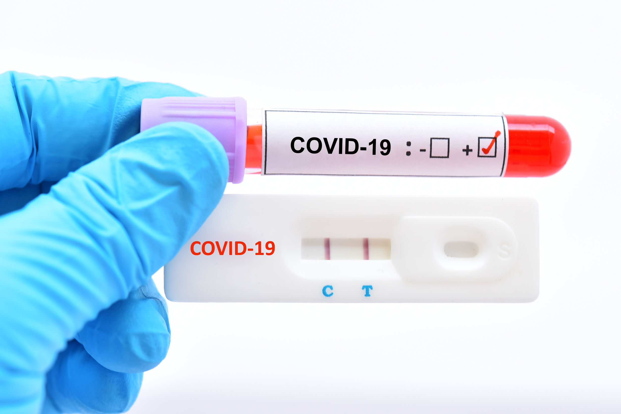 testcovid 08.01.22