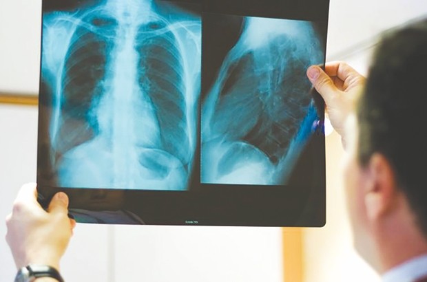 La Tuberculose est une maladie grave