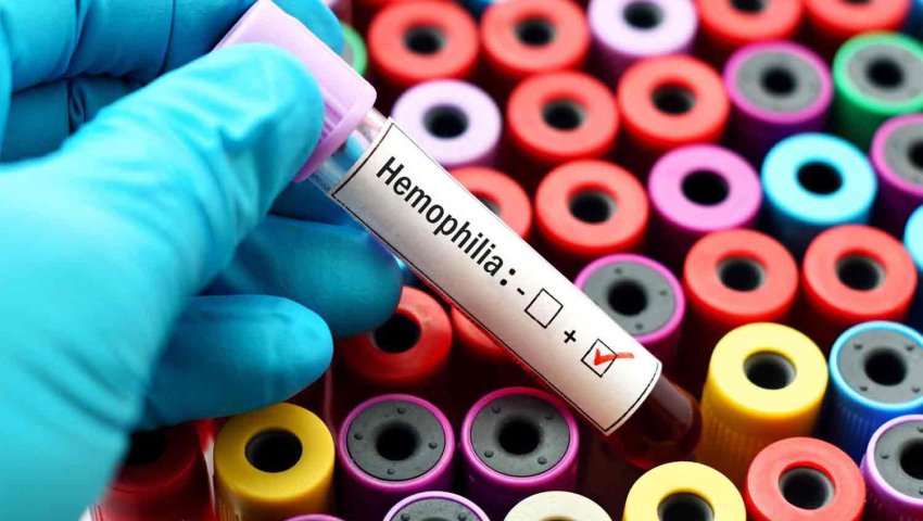 Hémophilie Algérie 17.05.2022