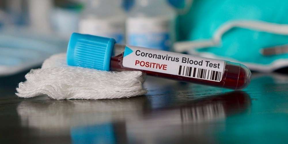 Coronavirus