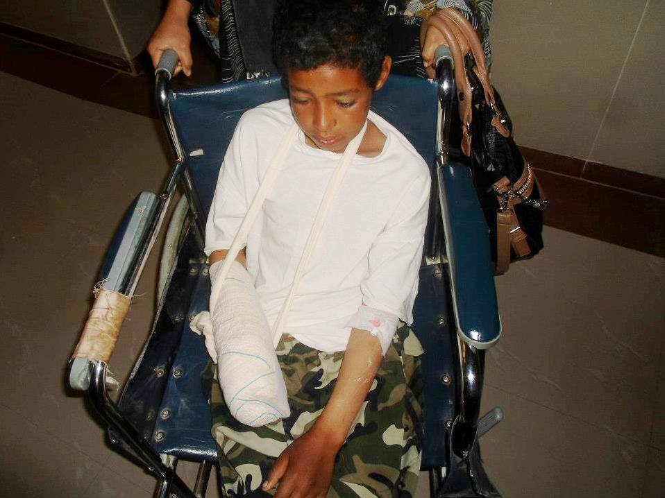 ألغام عنقودية مغربية