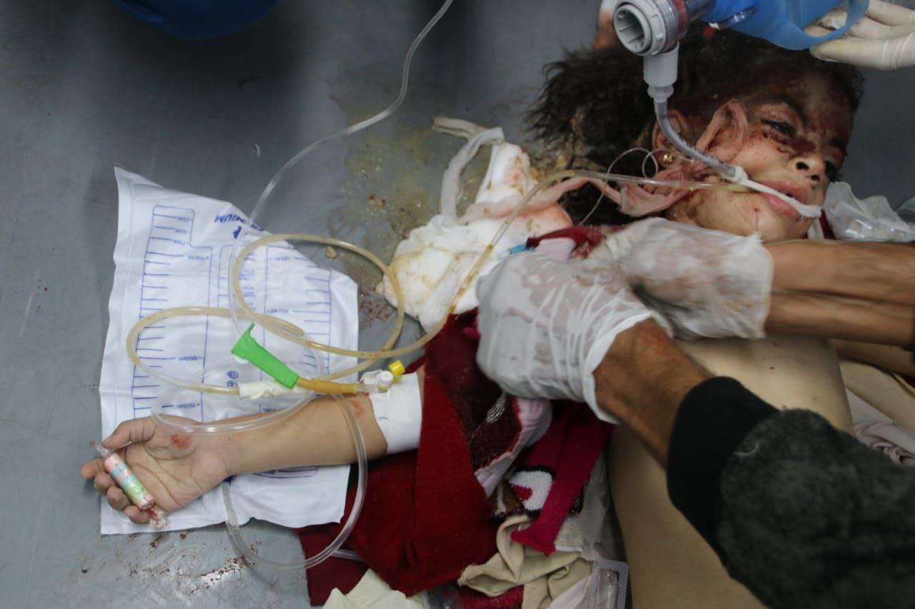 وصول أول الجرحى من غزة إلى الجزائر