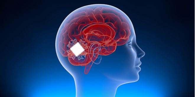 علماء يطورون أول شريحة دماغية لترجمة الأفكار إلى كلمات منطوقة