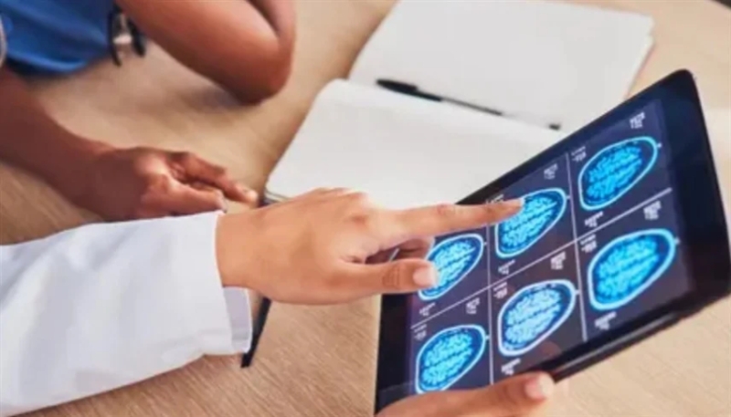 أورام الدماغ