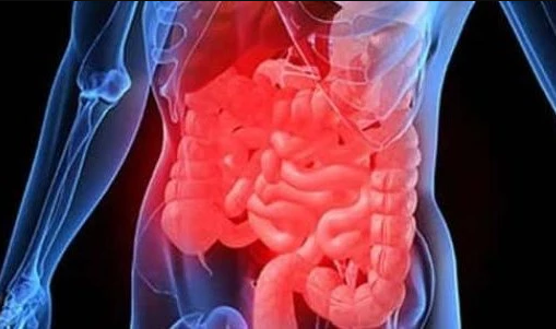 سبب خفي لمرض التهاب الأمعاء المزمن