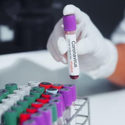 Covid-19 test