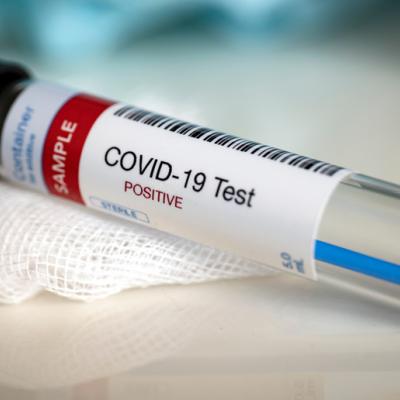 test covid 23.11.2021