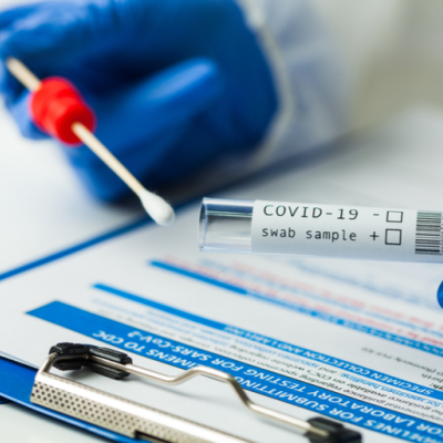 test covid 24.11.2021