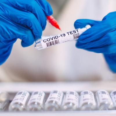 Covid-19 test