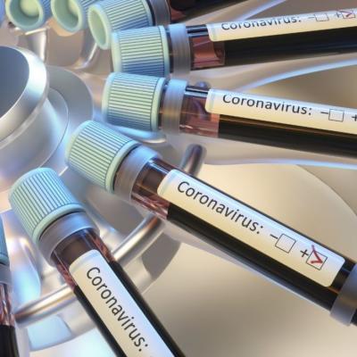 Covid-19 test