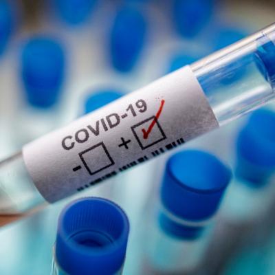 Covid-19 test