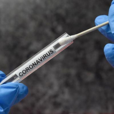 Covid-19 test