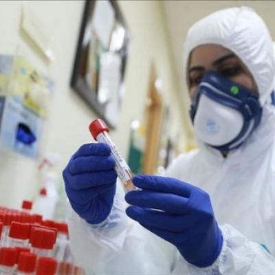Coronavirus.20.02.2022