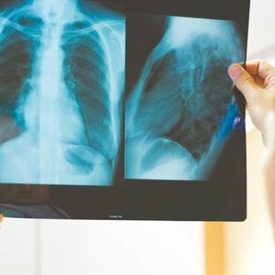 La Tuberculose est une maladie grave