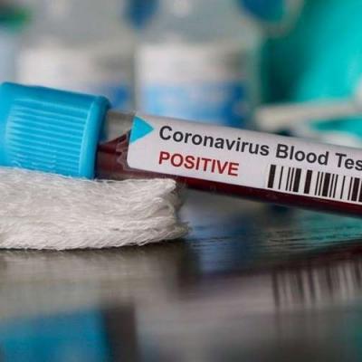 Coronavirus