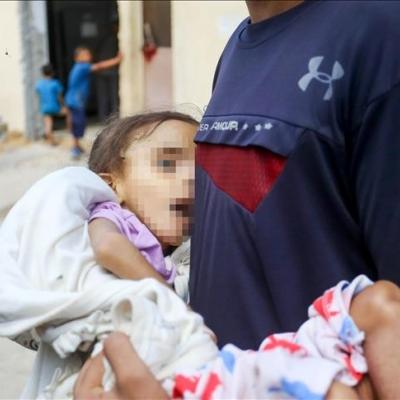 Gaza-Famine
