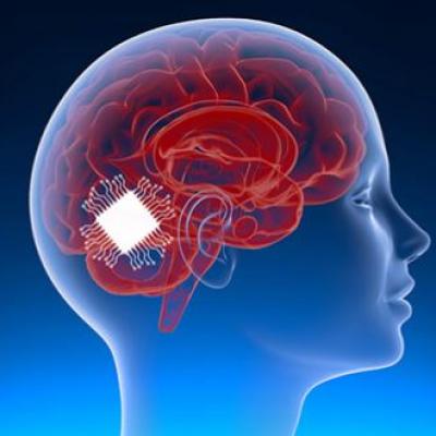  علماء يطورون أول شريحة دماغية لترجمة الأفكار إلى كلمات منطوقة