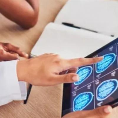 أورام الدماغ
