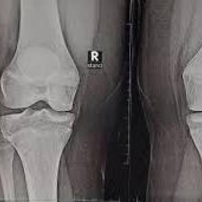 طب-ثورة