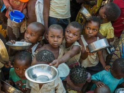أطفال يعانون الجوع في القرن الإفريقي