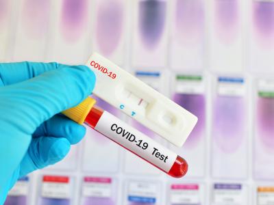 Covid-19 test