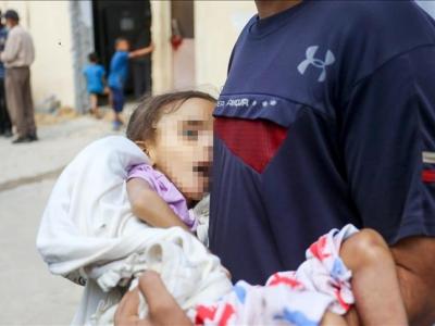 Gaza-Famine