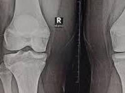 طب-ثورة